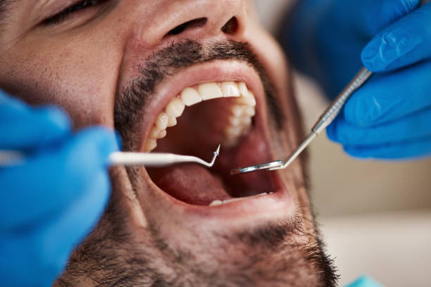 Best After-Hours Emergency Dentist in Rose Hill, VA