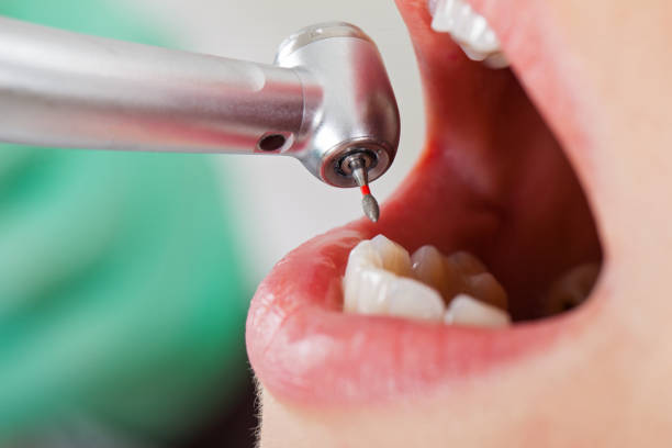 Best Walk-In Emergency Dentist in Rose Hill, VA
